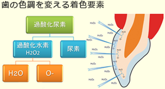 歯の色調を変える着色要素